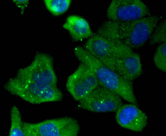 JNK2 Rabbit mAb