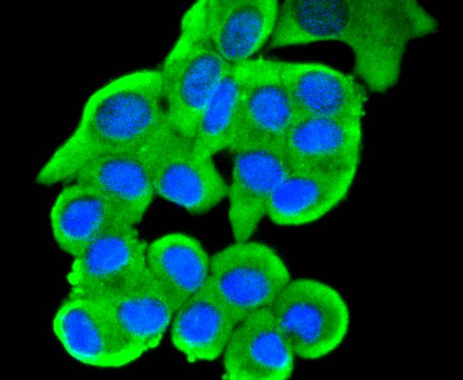 JNK2 Rabbit mAb