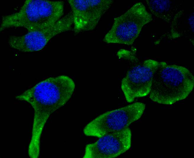 JNK2 Rabbit mAb