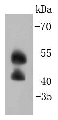 JNK2 Rabbit mAb