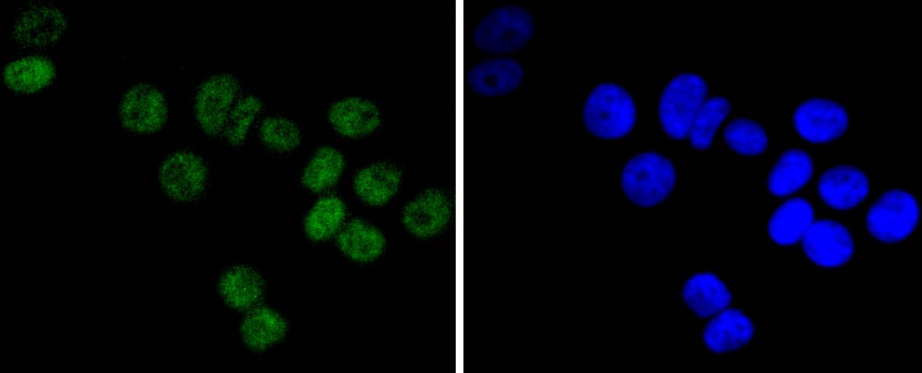 DNA PKcs Rabbit mAb