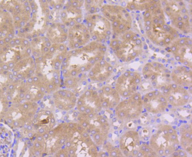 PBP Rabbit mAb
