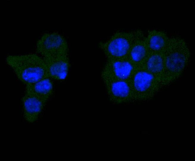 Caspase-6 Rabbit mAb