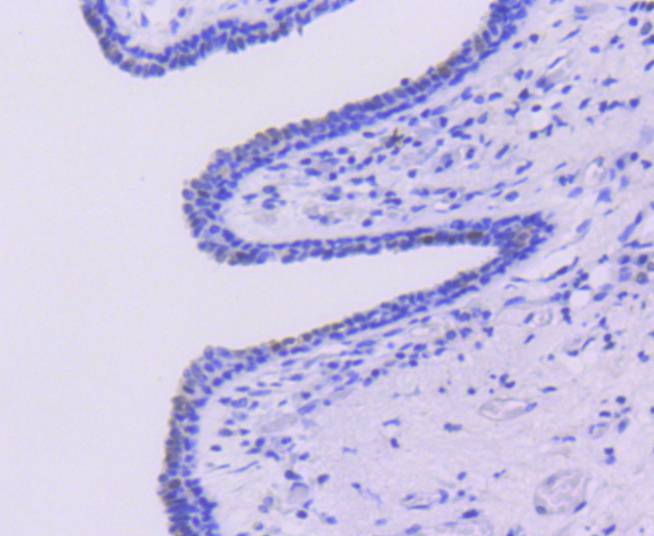Caspase-6 Rabbit mAb