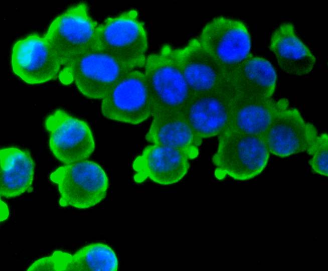 S100 beta Rabbit mAb