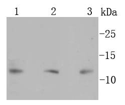 S100 beta Rabbit mAb