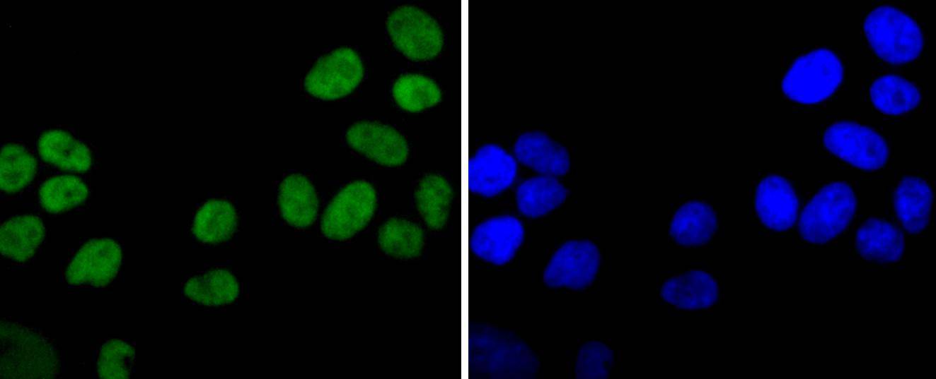 Ku80 Rabbit mAb