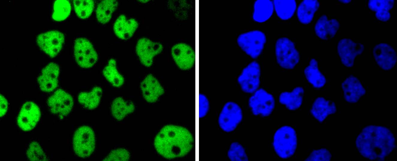 p63 Rabbit mAb