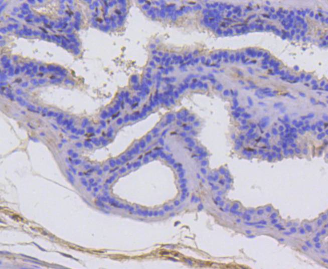 p63 Rabbit mAb