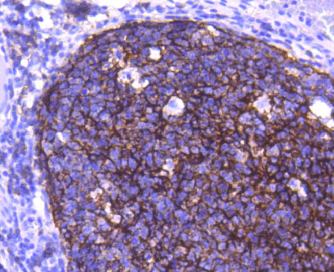 CD21 Rabbit mAb
