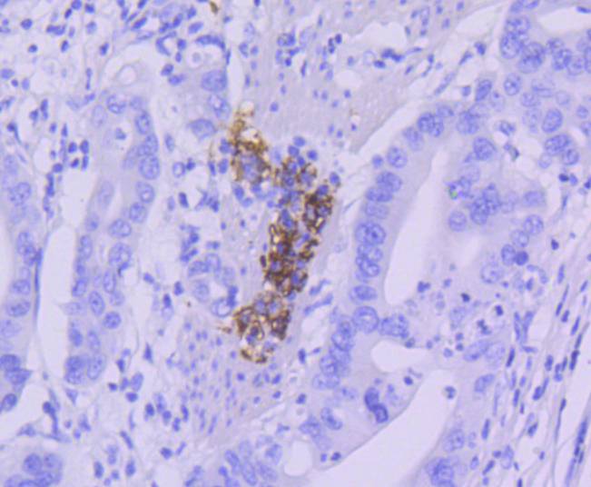 CD21 Rabbit mAb