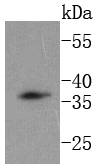DKK1 Rabbit mAb