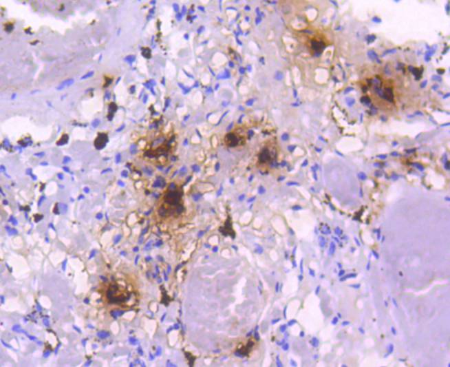 Mast Cell Tryptase Rabbit mAb