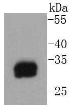 Mast Cell Tryptase Rabbit mAb