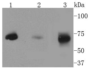 MEKK2 Rabbit mAb