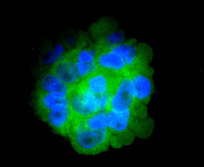 CD14 Rabbit mAb
