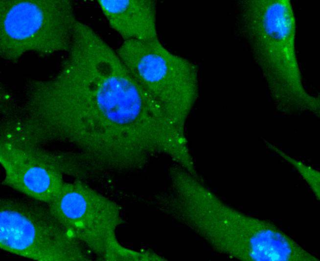 CD14 Rabbit mAb