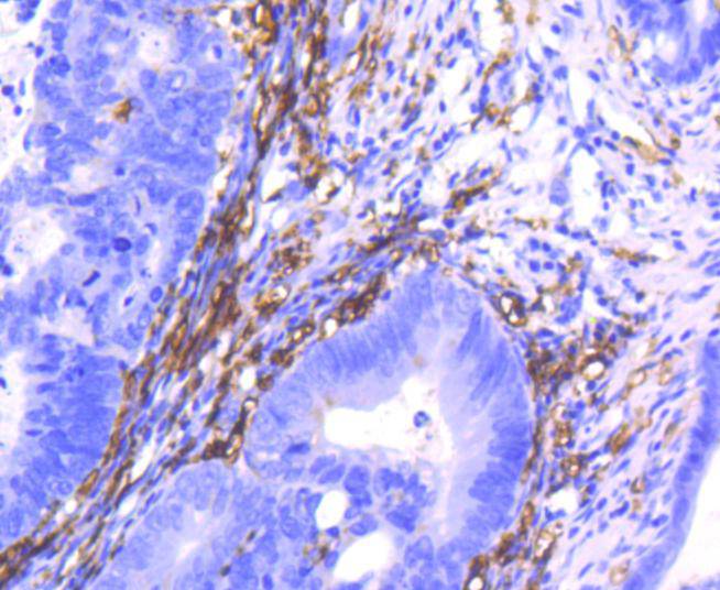 CD14 Rabbit mAb