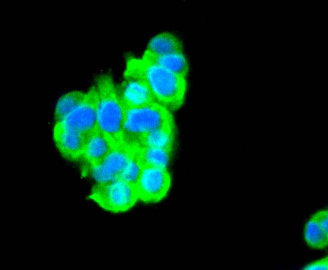 C/EBP Beta Rabbit mAb