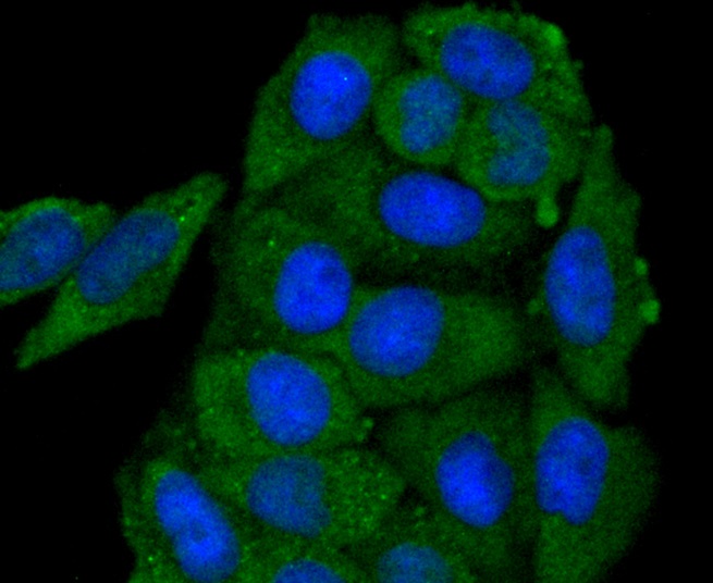 GAP43 Rabbit mAb