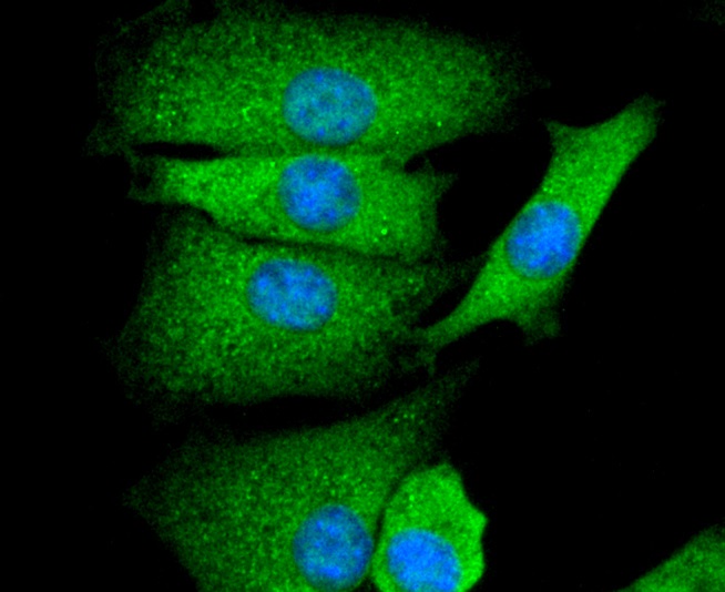 GAP43 Rabbit mAb