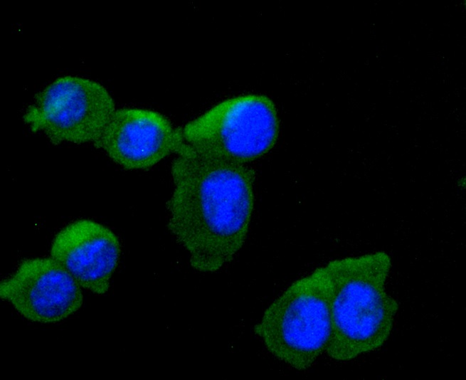 Tyrosine Hydroxylase Rabbit mAb