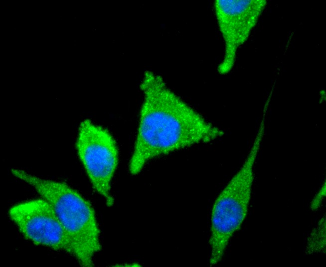 Tyrosine Hydroxylase Rabbit mAb
