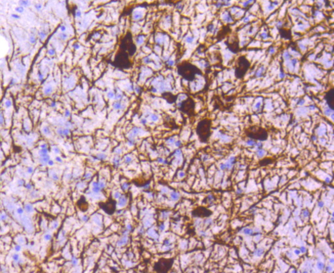 Tyrosine Hydroxylase Rabbit mAb