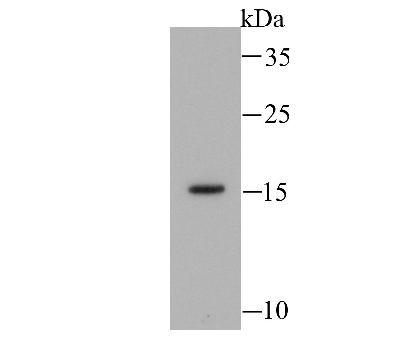 Myosin Light Chain 2 Rabbit mAb