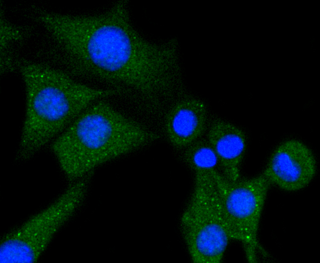Phospholipase C gamma 1 Rabbit mAb