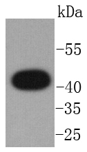 GPCR RDC1 Rabbit mAb