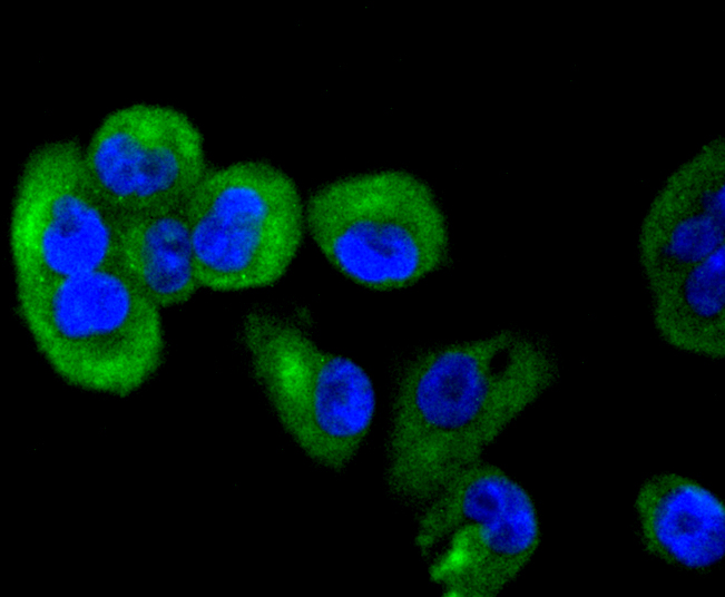 TACC3 Rabbit mAb