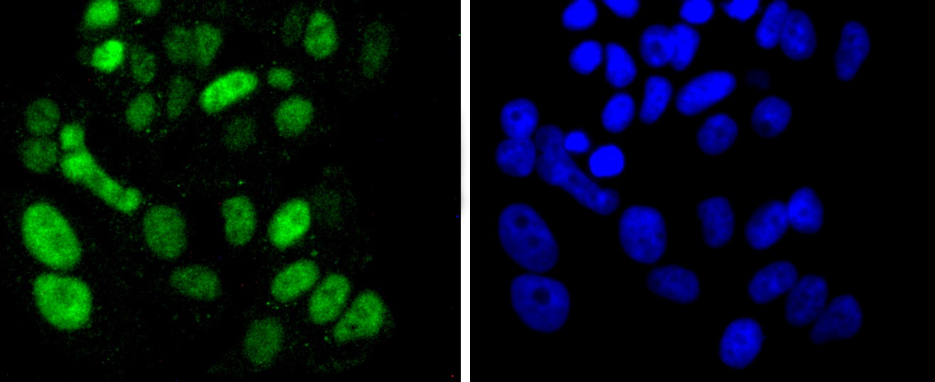 SOX9 Rabbit mAb
