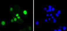 SOX9 Rabbit mAb