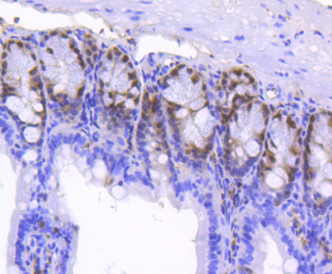 SOX9 Rabbit mAb