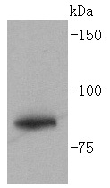 Glycogen synthase Rabbit mAb