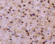 PPP1R1A Rabbit mAb