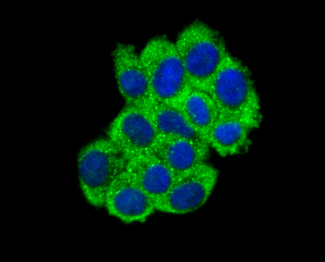 ABCF1 Rabbit mAb