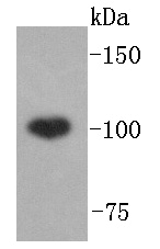 ABCF1 Rabbit mAb