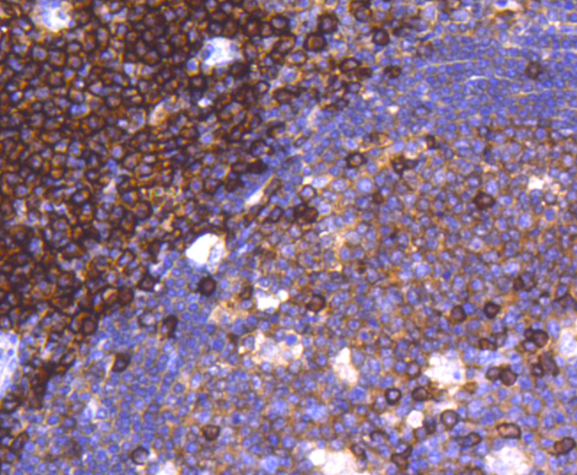 CD38 Rabbit mAb