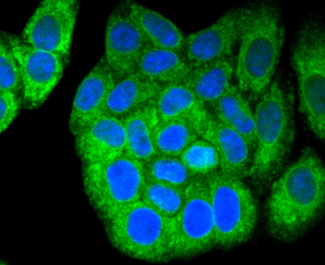 Calnexin Rabbit mAb