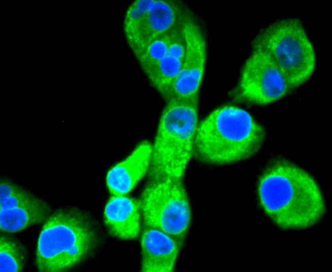 Calnexin Rabbit mAb