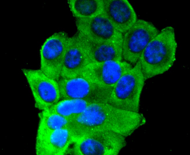 Insulin Receptor Beta Rabbit mAb