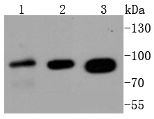 Insulin Receptor Beta Rabbit mAb