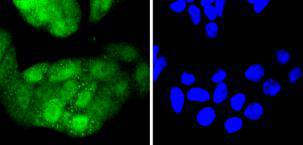 Cdk4 Rabbit mAb