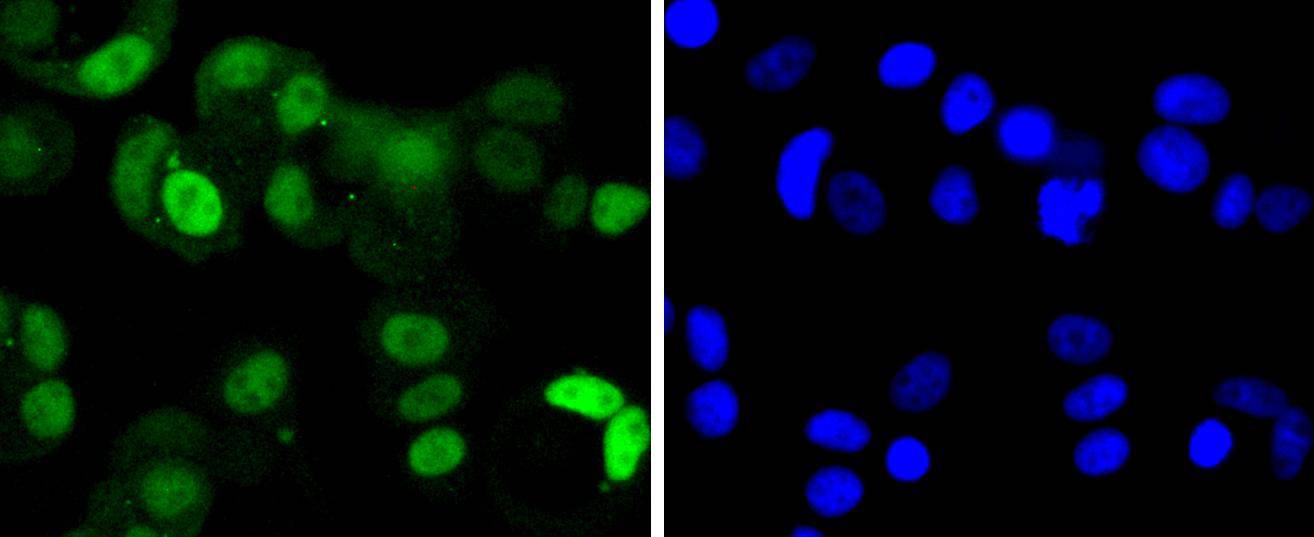 Cdk4 Rabbit mAb