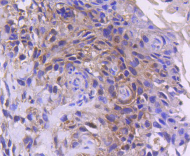 Cdk4 Rabbit mAb