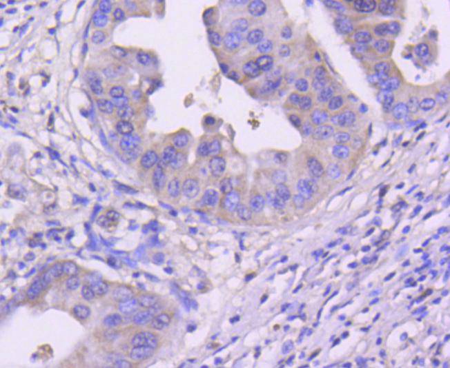 Cdk4 Rabbit mAb