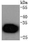 Cdk4 Rabbit mAb