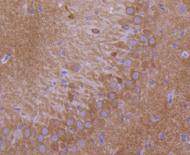 Glutamate receptor 1 Rabbit mAb
